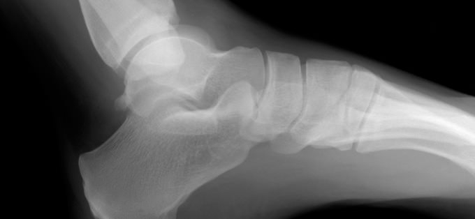 Fisioterapia y osteopatía